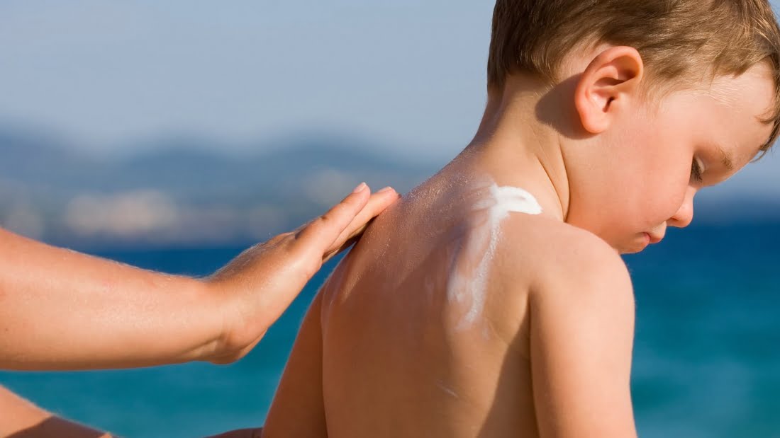 ممانعت از آفتاب سوختگی پوست -لیمونا